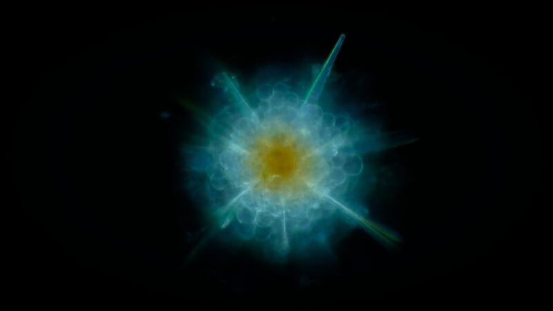 A glowing, spherical microorganism with a bright yellow center and teal, star-like rays extending outward, set against a black background.