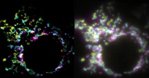 Nieuwe superresolutie-microscopie maakt het mogelijk om cellen in realtime te bestuderen