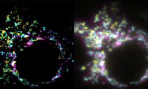 Nieuwe superresolutie-microscopie maakt het mogelijk om cellen in realtime te bestuderen