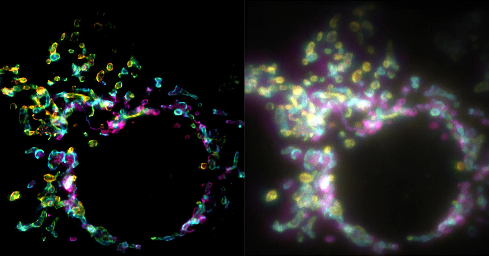 Nieuwe superresolutie-microscopie maakt het mogelijk om cellen in realtime te bestuderen